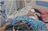 कोटा में कैसे हुई प्रसूताओं की मौत? AIIMS और SMS मेडिकल कॉलेज के डॉक्टरों का बड़ा खुलासा