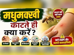 मधुमक्खी काट ले तो फौरन क्या करना चाहिए? जानिए सही तरीका, वरना बढ़ सकती है परेशानी