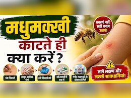 मधुमक्खी काट ले तो फौरन क्या करना चाहिए? जानिए सही तरीका, वरना बढ़ सकती है परेशानी