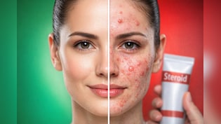 सावधान! गोरा होने के चक्&zwj;कर में चेहरे पर लगा रहे हैं Betnovate Cream? हो सकते हैं गंभीर नुकसान, डॉक्टर की चेतावनी