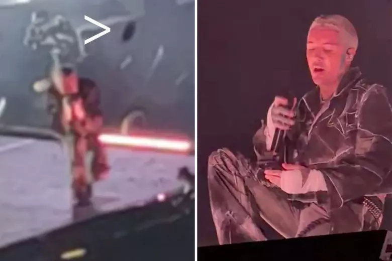 Bring Me The Horizon Frontman Oli Sykes Suffers Head Injury After Audience Member Throws Phone On Stage