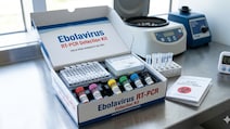 Ebola Outbreak: Why RT-PCR Is The Gold Standard For Testing Infections