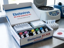 Ebola Outbreak: Why RT-PCR Is The Gold Standard For Testing Infections