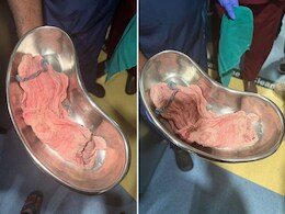 मुंबई के नूर अस्पताल में डिलीवरी के बाद महिला के पेट में छोड़े हैंड ग्लव्स और बैंडेज, हालत बिगड़ी