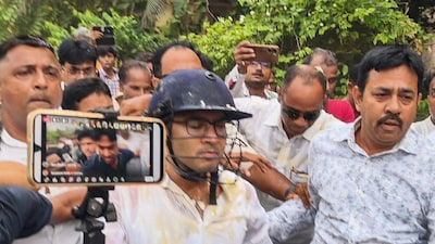 मुझे मारना चाहते थे, BJP प्रायोजित है पूरी साजिश', हमले के बाद बोले अभिषेक  बनर्जी | They wanted to kill me the entire conspiracy is BJP-sponsored said Abhishek  Banerjee after the attack