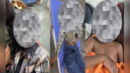 एसिड बना जानलेवा: ड्रिप लाइन सफाई के लिए रखा केन गिरा, मां की मौत, दो मासूम झुलसे