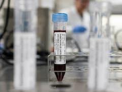 Hantavirus Update: US Patient With Symptoms Tests Negative
