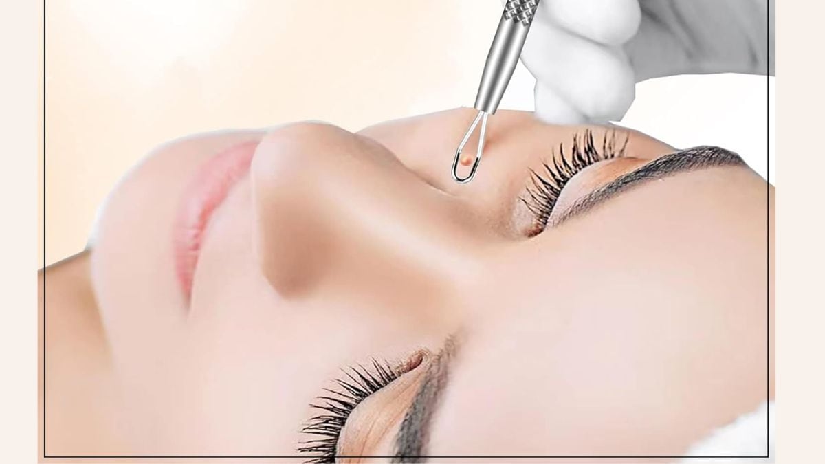Learn how to use gentle blackhead remover tools for careful and effective skin extraction. Learn how to use gentle blackhead remover tools for careful and effective skin extraction.