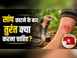 सांप काटने के बाद 10 मिनट की ये गलती बन सकती है मौत की वजह, एक्सपर्ट ने बताया सबसे पहले क्या करें