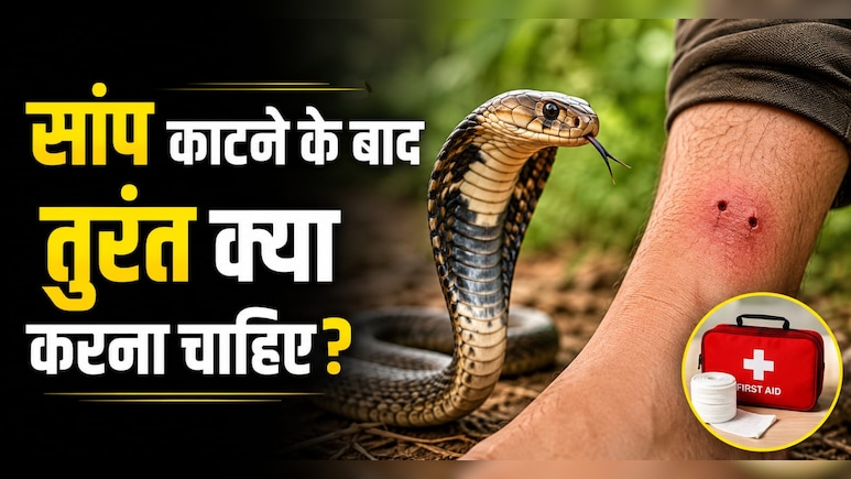 सांप काटने के बाद 10 मिनट की ये गलती बन सकती है मौत की वजह, एक्सपर्ट ने बताया सबसे पहले क्या करें