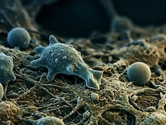 17 Deaths In 4 Months Due To Brain-Eating Amoeba In Kerala: What To Know