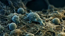 17 Deaths In 4 Months Linked To 'Brain-Eating Amoeba' In Kerala; Here's What You Should Know About The Fatal Brain Infection
