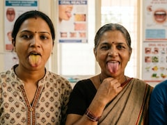 What Colour Is Your Tongue? Here's What It Says About Your Health