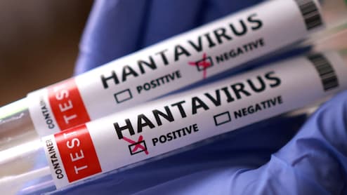 Hantavirus Scientists Were Close To Vaccine But Ran Out of Money