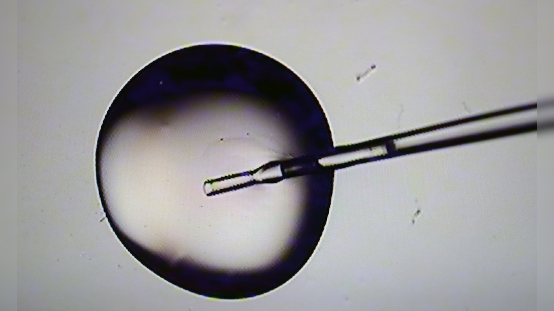 Trump Administration Proposes Rule to Expand Fertility Benefits