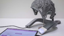 Swiss Start Up Uses Brain Stimulation To Help Alleviate Alzheimer's Disease, Dementia And Depression
