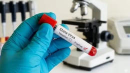 Another Sudanese National Isolated At Hyderabad Hospital Over Suspected Ebola Symptoms