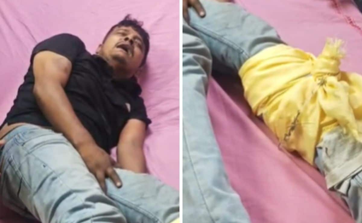 Cab driver Bablu injured in an encounter. Cab driver Bablu injured in an encounter.