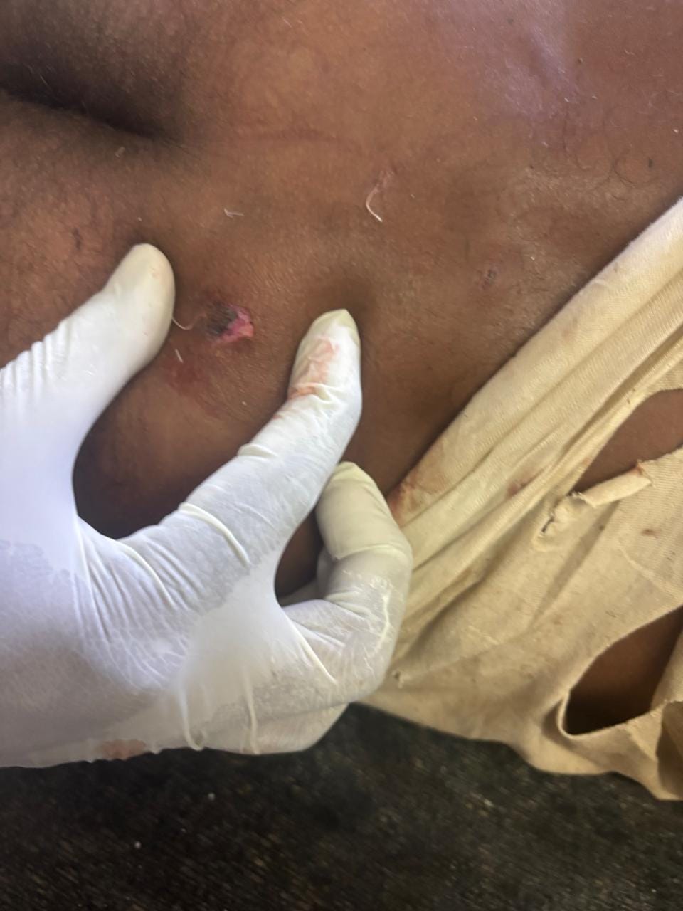 Sagar Tiger Attack: जख्म के निशान