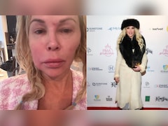 Brandi Glanville Reveals New Health Struggle After Facial Parasite Battle