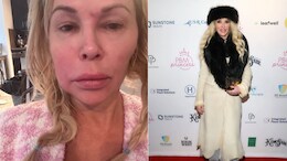 Brandi Glanville Says Doctors Dismissed Lump Before Tumour Discovery