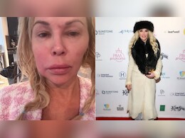 Brandi Glanville Says Doctors Dismissed Lump Before Tumour Discovery