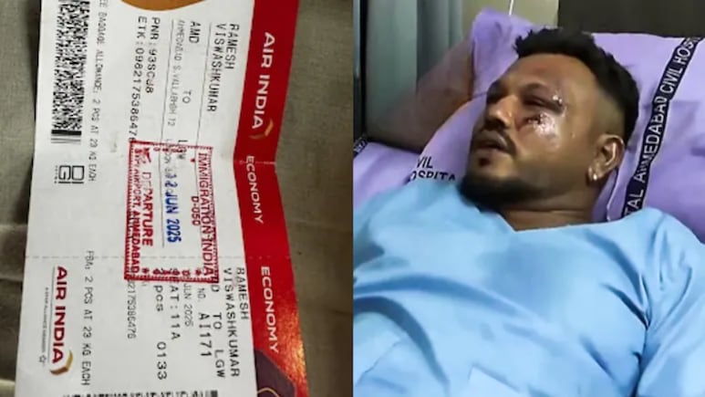 'People See I Survived, But...': Air India Ahmedabad Plane Crash Survivor Opens Up On Life After Tragedy
