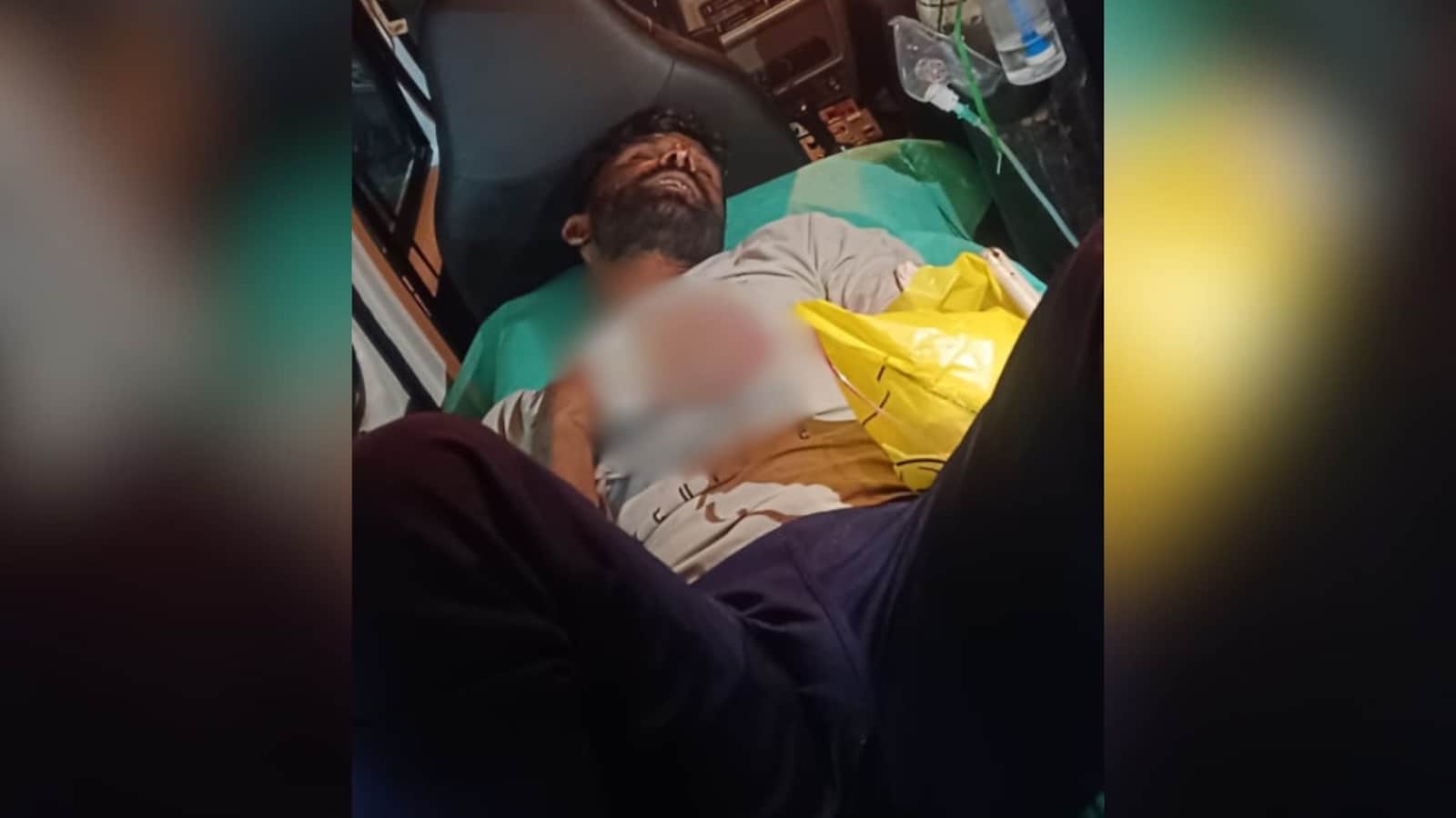 Man Visits Lover At Night. Her 2nd Boyfriend Severs His Hand