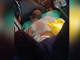 Man Visits Lover At Night. Her 2nd Boyfriend Severs His Hand