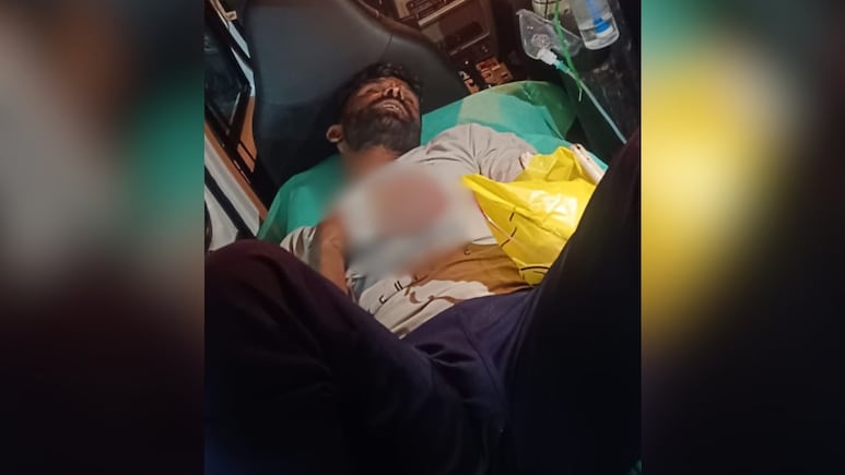 Man Visits Lover At Night. Her 2nd Boyfriend Severs His Hand