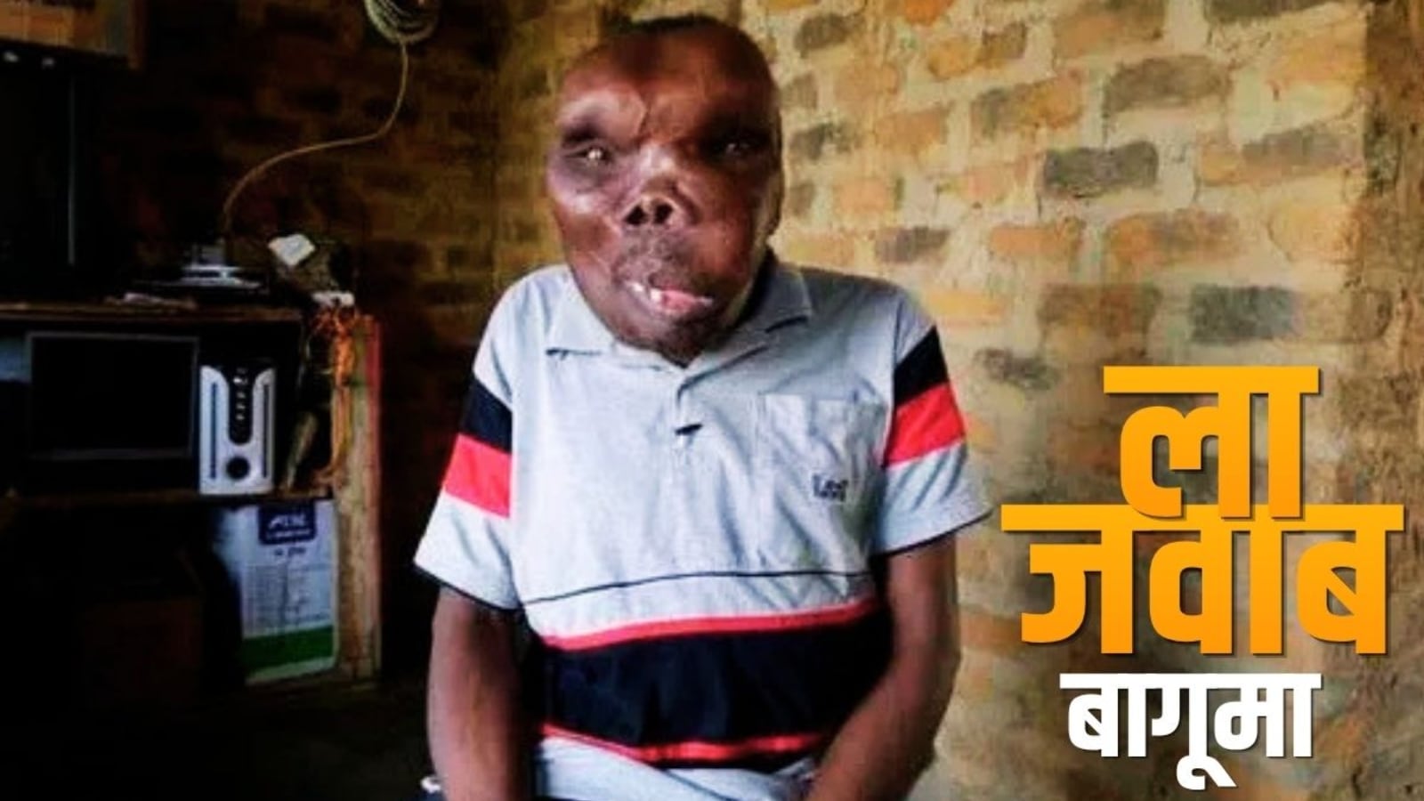 Ugliest Man: दुनिया का सबसे बदसूरत इंसान 'गॉडफ्रे बागूमा', तानों को बनाया तराना, 2 शादी से हैं 8 बच्चे!