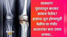 Osteoarthritis Treatment: गुडघ्यातून कटकट आवाज येतो? जिने चढताना त्रास होतो? डॉक्टरांनी केला धक्कादायक खुलासा