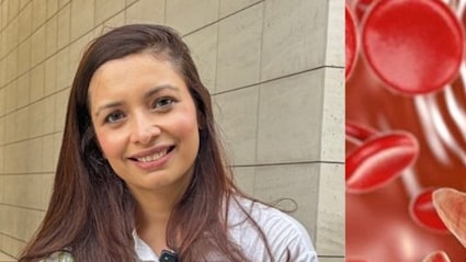 बार-बार थकान और चक्कर? हो सकती है आयरन की कमी, न्यूट्रिशनिस्ट ने बताएं बड़े कारण