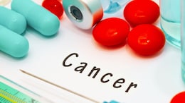 IISc Researchers Use Ultrasound To Selectively Kill Oral Cancer Cells