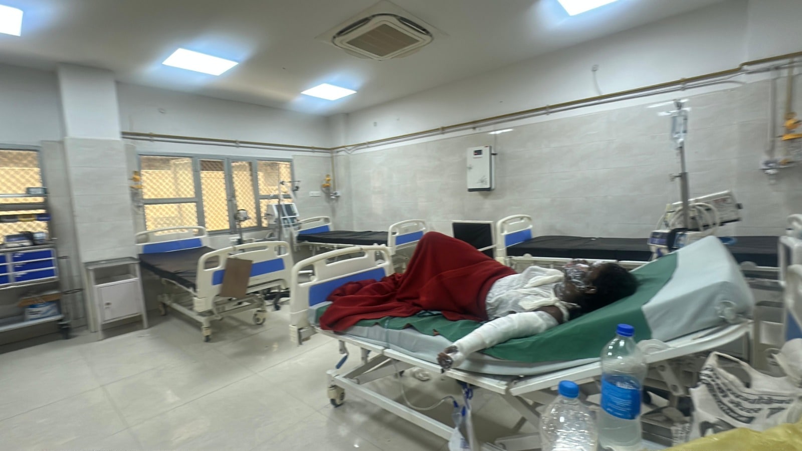 Hamidia Hospital Bhopal: गंभीर रुप से झुलसे मरीजों का एसी के बिना बुरा हाल है. अस्पताल प्रशासन ने कई बार चिट्ठियां लेकिन अफसरों ने अभी तक मंजूरी नहीं दी है.  