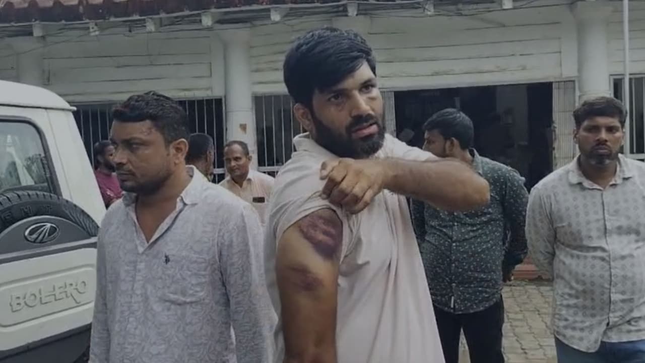 गोरखपुर में पुल‍िस पर बर्बरता का आरोप, तीन युवकों की बेरहमी से की पिटाई, अस्‍पताल में भर्ती