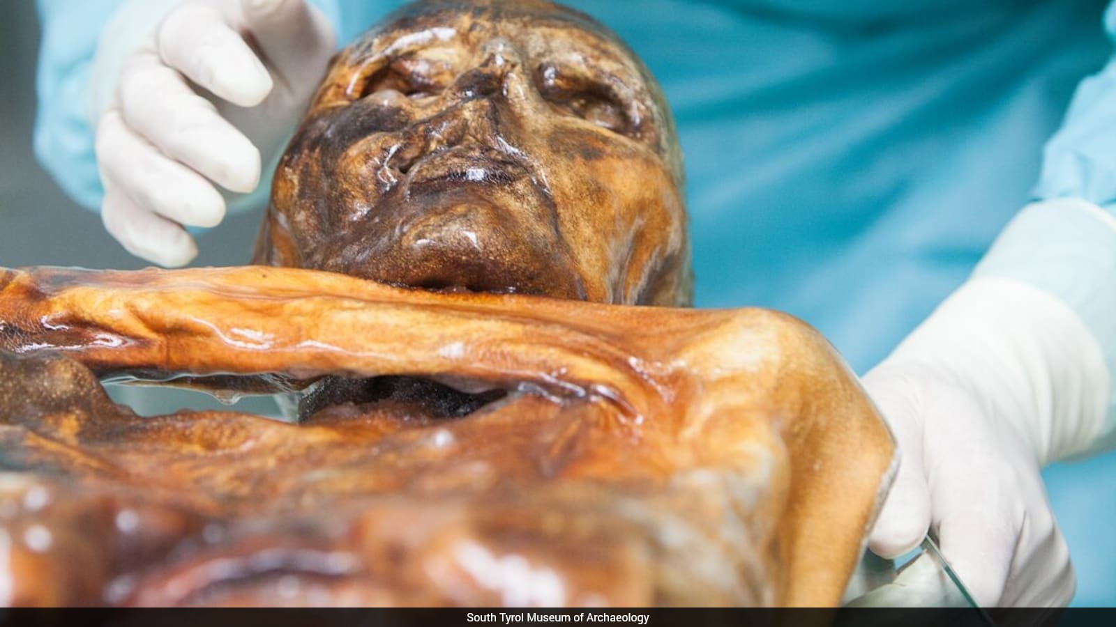 Otzi The Iceman: 5,300-Year-Old Mummy Microbiome Is Still Alive And Evolving