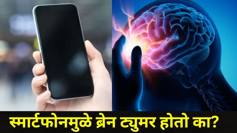 Does Smartphone Cause Brain Tumor : स्मार्टफोनमुळे ब्रेन ट्यूमर होतो का? काय आहे यामागचं सत्य आणि गैरसमज?