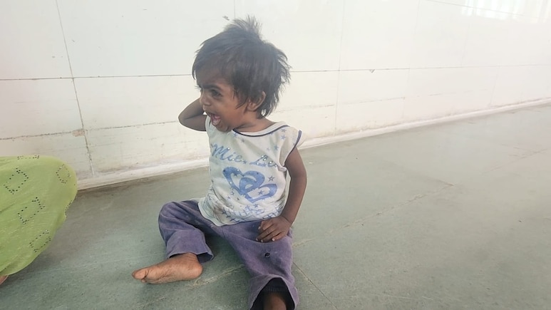 3 महीने से बच्चों का पोषण आहार बंद : करोड़ों की योजनाओं पर सवाल, विदिशा समेत 8 जिलों में कुपोषण का संकट