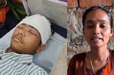 भाई को बचाने के लिए तेंदुए से भिड़ गई बहन, जबड़ों से सिर को खींचकर निकाला बाहर