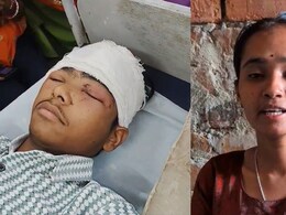 Rajasthan: भाई को बचाने के लिए तेंदुए से भिड़ गई बहन, जबड़ों से सिर को खींचकर निकाला बाहर