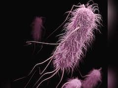 What Is Shigella? Kerala Reports 146 cases, Five Deaths In 6 Months &mdash; Symptoms, Precautions & Treatment