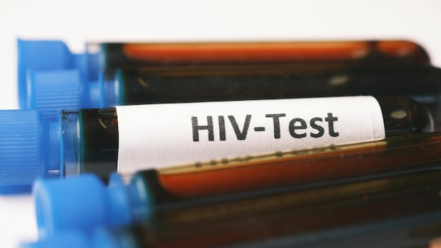 HIV Enters The Brain And Doesn't Leave - Paradoxically, Drugs Intended To Reduce Brain Inflammation Increase Virus Levels