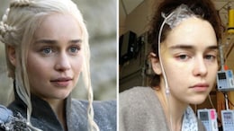 Why <i>Game Of Thrones</i> Star Emilia Clarke Compares Brain Injury Today To Cancer 100 Years Ago