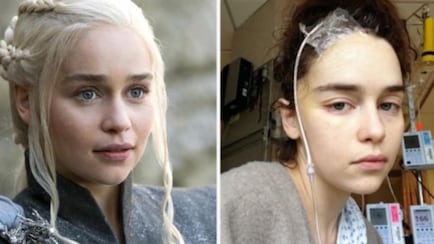 Why Game Of Thrones Star Emilia Clarke Compares Brain Today To Cancer
