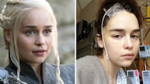 Why Game Of Thrones Star Emilia Clarke Compares Brain Injury To Cancer