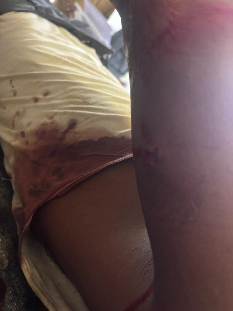 Sagar Tiger Attack: सागर में बाघ का हमला या गोली की गूंज