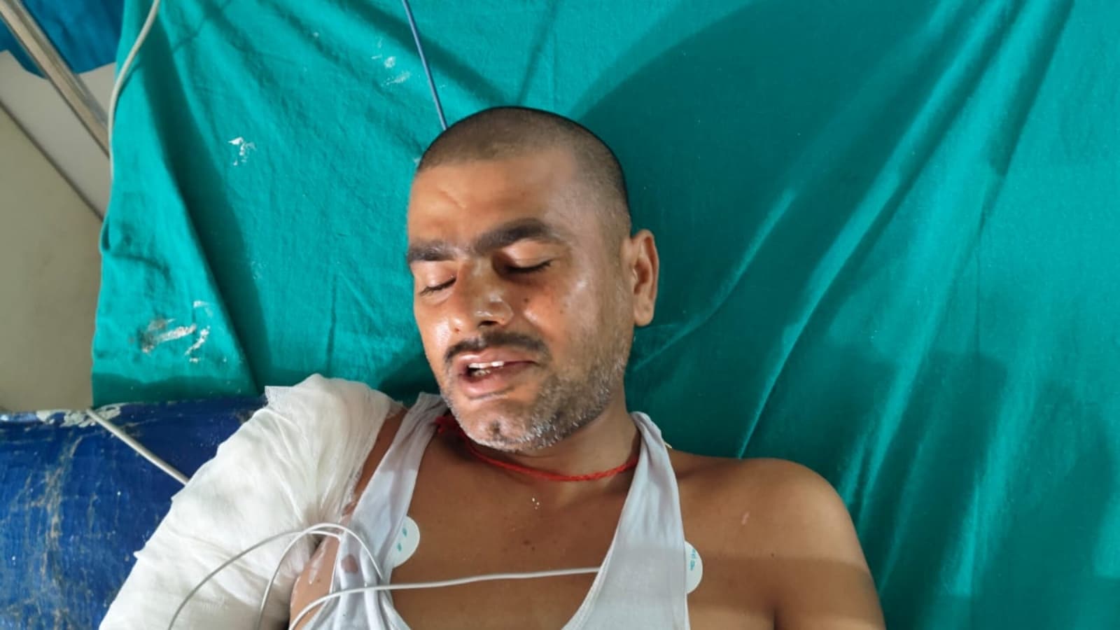 घायल अजीत कुमार का निजी अस्पताल में इलाज चल रहा है
