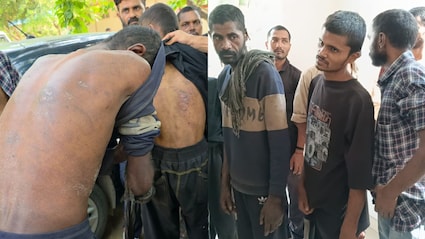पिटबुल से कटवाया, भाले दागे, हंटर मारे, मुजफ्फरनगर के बंधक मजूदरों की रूह कंपा देने वाली आपबीती