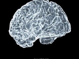 IIT Madras ने जारी किया दुनिया का डिटेल्ड 3D Human Brainstem Atlas, दिमाग की रिसर्च को मिल सकती है नई दिशा